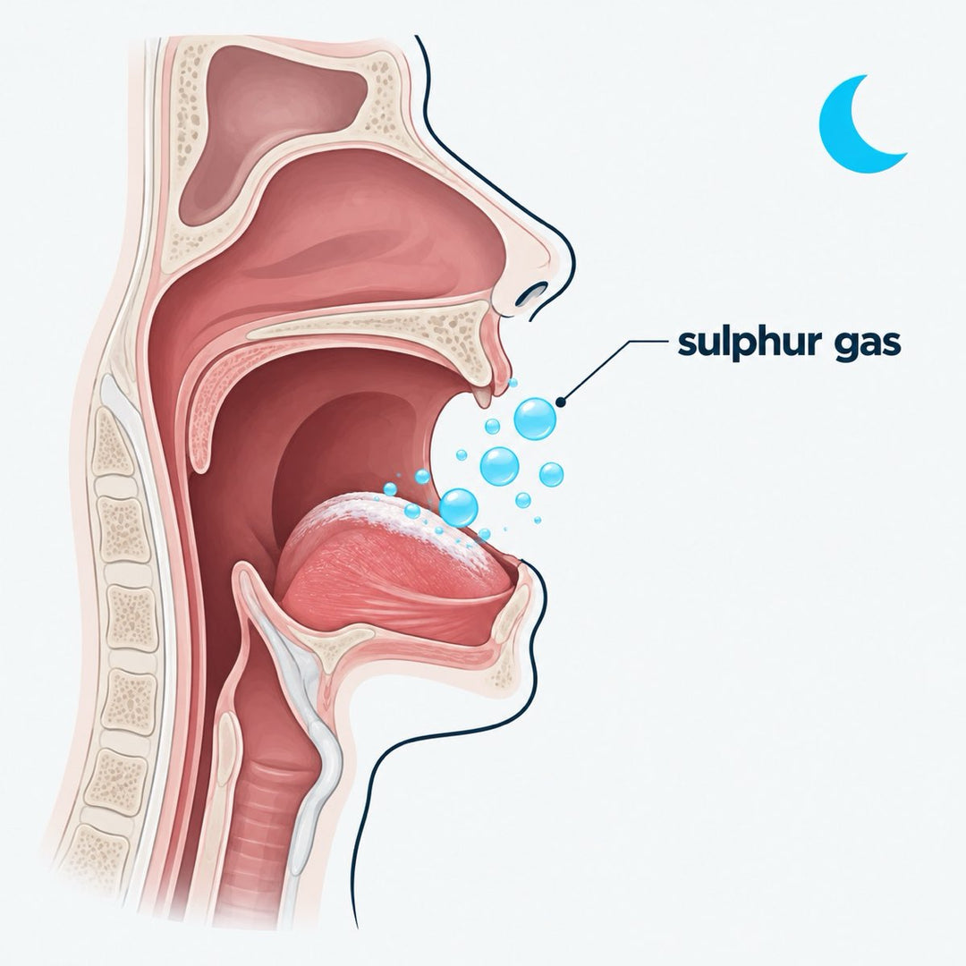 Drawing of the back of a tongue with a pale coating and gas bubbles rising.