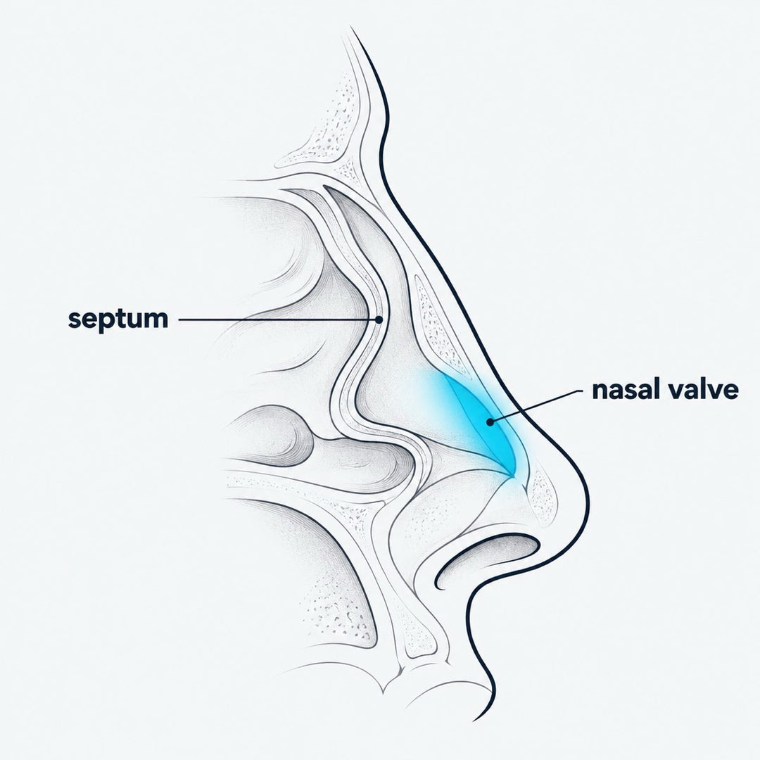 Drawing of a nose from the side: the bent wall in the middle, the soft valve at the front.