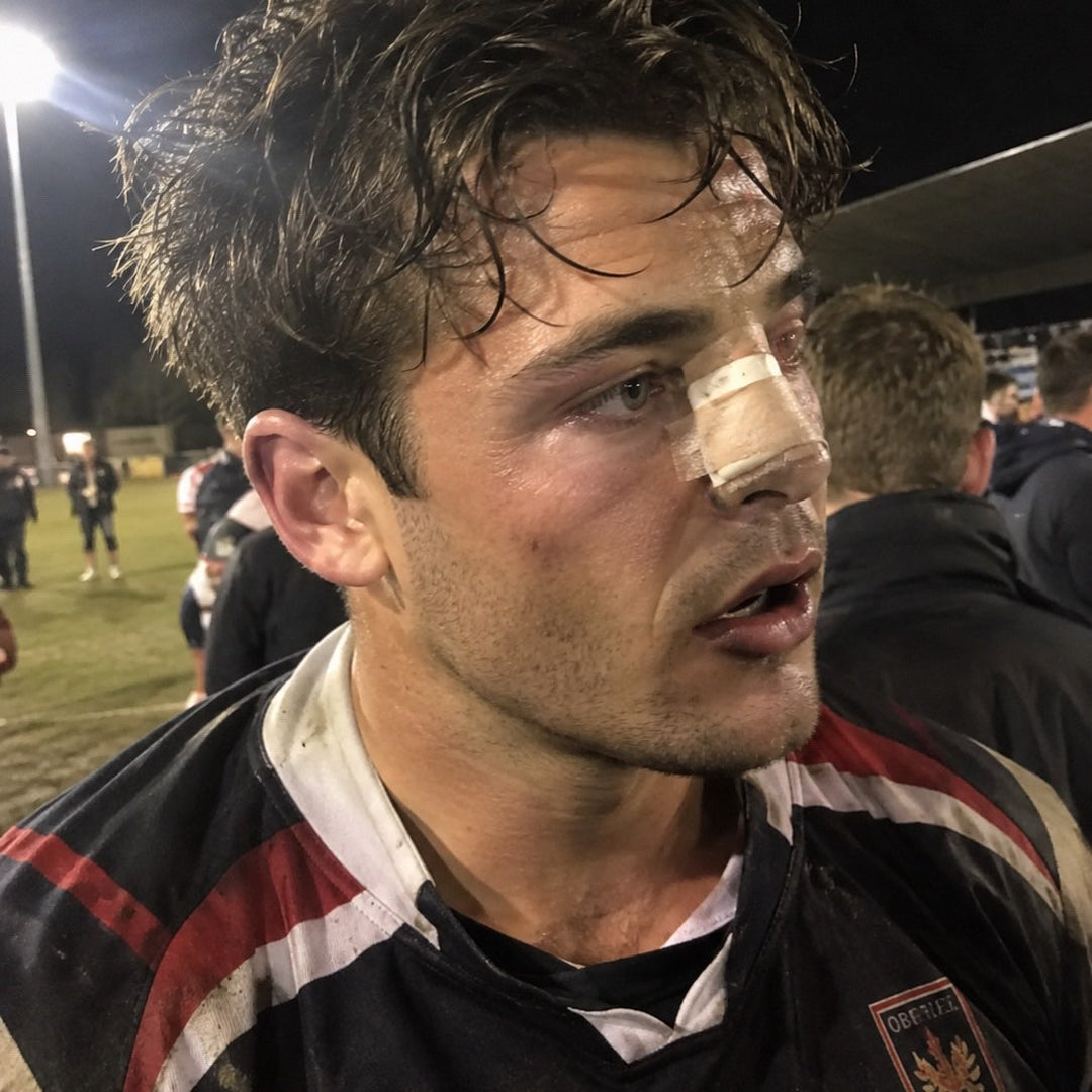 An old footy photo with a busted nose in it.